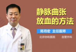 静脉曲张放血视频,直观视频解析